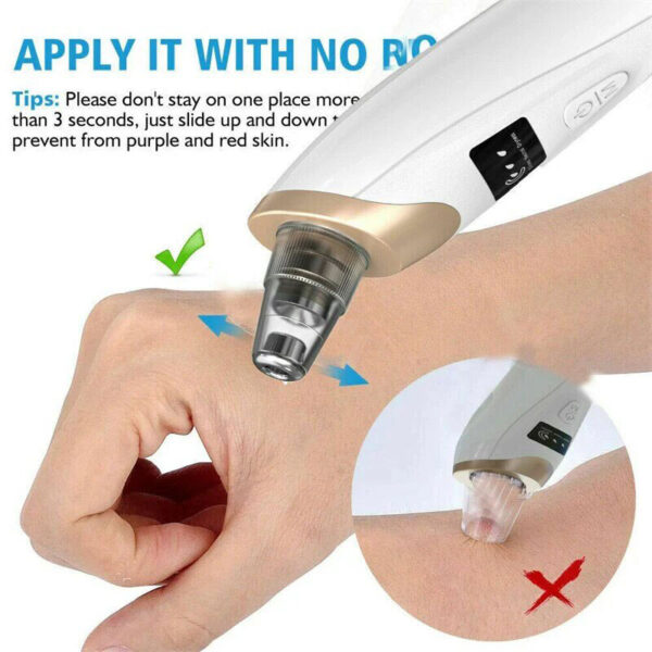 5 in 1 Electric Blackhead Remover - Image 4