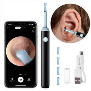 Smart Ear Cleaner Pro™ – HD Camera Ear Wax Remover with LED Light